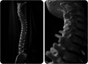 Jo Arellanes | Atlanta Photographer | Chiropractic Care | Spines